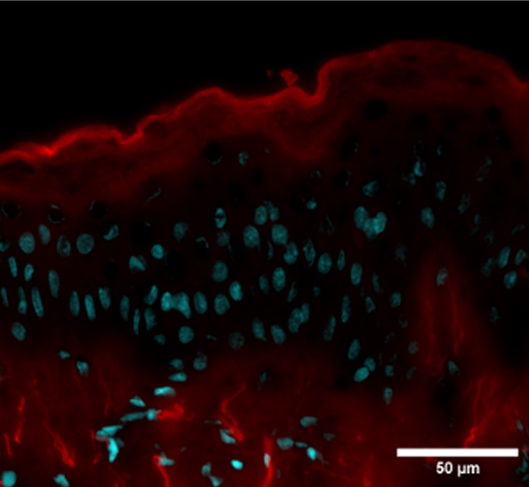 Condition stress + 1-LGVTY®