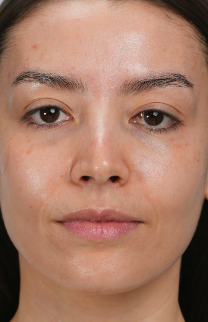 Image d’avant/après