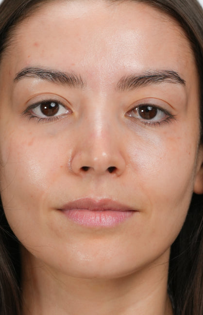 After — Treatment Tailored to Your Needs