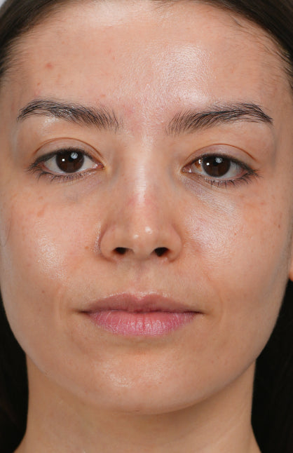 Before — Treatment Tailored to Your Needs